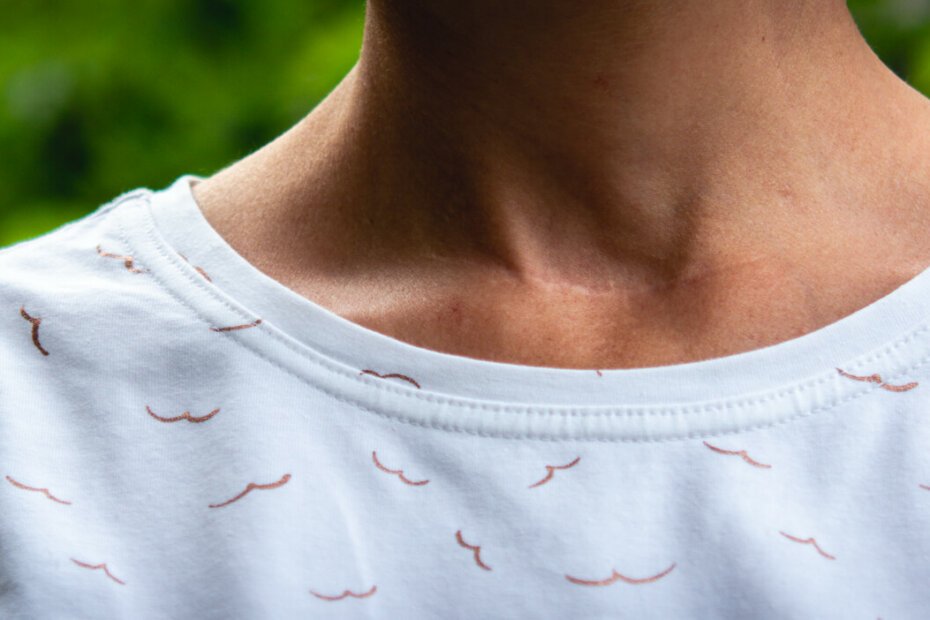 Pixie tee